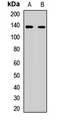 NRSF / REST Antibody - Western blot analysis of REST expression in MCF7 (A), HL60 (B) whole cell lysates.  