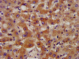 NSDHL Antibody - Immunohistochemistry image at a dilution of 1:400 and staining in paraffin-embedded human liver tissue performed on a Leica BondTM system. After dewaxing and hydration, antigen retrieval was mediated by high pressure in a citrate buffer (pH 6.0) . Section was blocked with 10% normal goat serum 30min at RT. Then primary antibody (1% BSA) was incubated at 4 °C overnight. The primary is detected by a biotinylated secondary antibody and visualized using an HRP conjugated SP system.