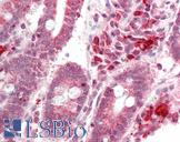 NSMCE4A / NSE4A Antibody - Human Small Intestine: Formalin-Fixed, Paraffin-Embedded (FFPE).  This image was taken for the unconjugated form of this product. Other forms have not been tested.