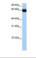 NSUN6 Antibody - Fetal muscle cell lysate. Antibody concentration: 0.5 ug/ml. Gel concentration: 12%.  This image was taken for the unconjugated form of this product. Other forms have not been tested.