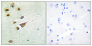 NT5C3A Antibody - Immunohistochemistry analysis of paraffin-embedded human brain tissue, using NT5C3 Antibody. The picture on the right is blocked with the synthesized peptide.