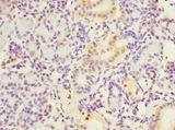 NT5C3A Antibody - Immunohistochemistry of paraffin-embedded human pancreatic tissue at dilution 1:100