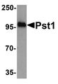 NT5C3B / NT5C3L Antibody - Western blot analysis of TM yeast Pst1 protein (50 ng) with Pst1 antibody at 1 ug/ml.