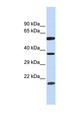 NT5DC1 Antibody - NT5DC1 antibody Western blot of Fetal Brain lysate. This image was taken for the unconjugated form of this product. Other forms have not been tested.
