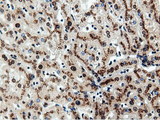 NT5DC1 Antibody - Immunohistochemical staining of paraffin-embedded Human liver tissue using anti-NT5DC1 mouse monoclonal antibody.
