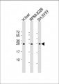 NT5M Antibody - All lanes: Anti-NT5M Antibody (C-Term) at 1:2000 dilution. Lane 1: human liver lysate. Lane 2: RPMI-8226 whole cell lysate. Lane 3: SH-SY5Y lysate Lysates/proteins at 20 ug per lane. Secondary Goat Anti-Rabbit IgG, (H+L), Peroxidase conjugated at 1:10000 dilution. Predicted band size: 26 kDa. Blocking/Dilution buffer: 5% NFDM/TBST.