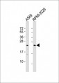 NT5M Antibody - All lanes: Anti-NT5M Antibody (Center) at 1:2000 dilution Lane 1: A549 whole cell lysate Lane 2: RPMI-8226 whole cell lysate Lysates/proteins at 20 µg per lane. Secondary Goat Anti-Rabbit IgG, (H+L), Peroxidase conjugated at 1/10000 dilution. Predicted band size: 26 kDa Blocking/Dilution buffer: 5% NFDM/TBST.