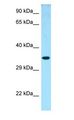 NTHL1 Antibody - NTHL1 antibody Western Blot of Fetal Lung.  This image was taken for the unconjugated form of this product. Other forms have not been tested.
