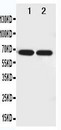 NTN1 / Netrin 1 Antibody - WB of NTN1 / Netrin 1 antibody. All lanes: Anti-NTN1 at 0.5ug/ml. Lane 1: U87 Whole Cell Lysate at 40ug. Lane 2: COLO320 Whole Cell Lysate at 40ug. Predicted bind size: 67KD. Observed bind size: 67KD.