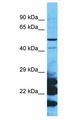 NTN5 Antibody - NTN5 antibody Western Blot of 293T. Antibody dilution: 1 ug/ml.  This image was taken for the unconjugated form of this product. Other forms have not been tested.