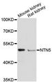 NTN5 Antibody - Western blot analysis of extracts of various cell lines, using NTN5 antibody at 1:3000 dilution. The secondary antibody used was an HRP Goat Anti-Rabbit IgG (H+L) at 1:10000 dilution. Lysates were loaded 25ug per lane and 3% nonfat dry milk in TBST was used for blocking. An ECL Kit was used for detection and the exposure time was 90s.