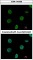 NTPCR / C1orf57 Antibody - Immunofluorescence of paraformaldehyde-fixed HeLa using C1orf57 antibody at 1:500 dilution.