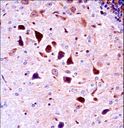 NTRK3 / TRKC Antibody - Mouse Ntrk3 Antibody immunohistochemistry of formalin-fixed and paraffin-embedded mouse brain tissue followed by peroxidase-conjugated secondary antibody and DAB staining.