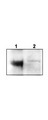 NTRK3 / TRKC Antibody - Anti-TrkCT1 Antibody - Western Blot. Western blot of affinity purified anti-TrkCT1 to detect endogenous TrkCT1 in mouse cortex lysate (Lane 1). Lane 2 is TrkCT1 knock-out cortex lysate. Cell extracts were resolved by electrophoresis and transferred to nitrocellulose. The membrane was probed with the primary antibody at a 1:6000 dilution. Personal Communication, V. Coppola, CCRNCI, Frederick, MD.