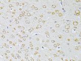 NTS / NT / Neurotensin Antibody - Immunohistochemistry of paraffin-embedded mouse brain using NTS antibody at dilution of 1:100 (40x lens).