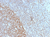 Nuclear Antigen Antibody - Formalin-fixed, paraffin-embedded human Tonsil stained with Pan-Nuclear Antigen Rabbit Recombinant Monoclonal Antibody (NM2984R).