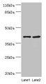 NUDCD3 Antibody - Western blot All lanes: EXOSC5 antibody at 5µg/ml Lane 1: 293T whole cell lysate Lane 2: Hela whole cell lysate Lane 3: Hela whole cell lysate Secondary Goat polyclonal to rabbit IgG at 1/10000 dilution Predicted band size: 41 kDa Observed band size: 41 kDa