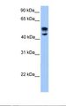 NUDR / DEAF1 Antibody - Fetal brain lysate. Antibody concentration: 1.0 ug/ml. Gel concentration: 12%.  This image was taken for the unconjugated form of this product. Other forms have not been tested.