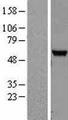 NUDT12 Protein - Western validation with an anti-DDK antibody * L: Control HEK293 lysate R: Over-expression lysate