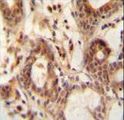 NUDT15 Antibody - NUDT15 antibody immunohistochemistry of formalin-fixed and paraffin-embedded human breast tissue followed by peroxidase-conjugated secondary antibody and DAB staining.