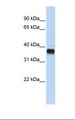 NUDT18 Antibody - Transfected 293T cell lysate. Antibody concentration: 1.0 ug/ml. Gel concentration: 12%.  This image was taken for the unconjugated form of this product. Other forms have not been tested.