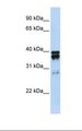 NUDT18 Antibody - 293T cell lysate. Antibody concentration: 1.0 ug/ml. Gel concentration: 12%.  This image was taken for the unconjugated form of this product. Other forms have not been tested.