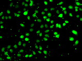 NUDT2 Antibody - Immunofluorescence analysis of HeLa cells.