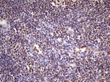 NUDT21 Antibody - IHC of paraffin-embedded Human tonsil using anti-NUDT21 mouse monoclonal antibody. (Heat-induced epitope retrieval by 1 mM EDTA in 10mM Tris, pH8.5, 120°C for 3min)(1:150).