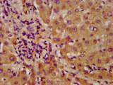 NUDT5 Antibody - Immunohistochemistry image at a dilution of 1:600 and staining in paraffin-embedded human liver tissue performed on a Leica BondTM system. After dewaxing and hydration, antigen retrieval was mediated by high pressure in a citrate buffer (pH 6.0) . Section was blocked with 10% normal goat serum 30min at RT. Then primary antibody (1% BSA) was incubated at 4 °C overnight. The primary is detected by a biotinylated secondary antibody and visualized using an HRP conjugated SP system.