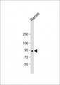 NUGGC Antibody - Anti-C8orf80 Antibody (N-Term) at 1:2000 dilution + Ramos whole cell lysate Lysates/proteins at 20 µg per lane. Secondary Goat Anti-Rabbit IgG, (H+L), Peroxidase conjugated at 1/10000 dilution. Predicted band size: 91 kDa Blocking/Dilution buffer: 5% NFDM/TBST.