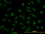 NUP133 Antibody - Immunofluorescence of monoclonal antibody to NUP133 on HeLa cell. [antibody concentration 10 ug/ml]