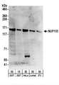 NUP155 Antibody - Detection of Human and Mouse NUP155 by Western Blot. Samples: Whole cell lysate from 293T (15 and 50 ug), HeLa (50 ug), Jurkat (50 ug), and mouse NIH3T3 (50 ug) cells. Antibodies: Affinity purified rabbit anti-NUP155 antibody used for WB at 0.1 ug/ml. Detection: Chemiluminescence with an exposure time of 3 minutes.