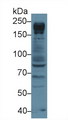 NUP205 Antibody - Western Blot; Sample: Human Jurkat cell lysate; Primary Ab: 3µg/ml Rabbit Anti-Human NUP205 Antibody Second Ab: 0.2µg/mL HRP-Linked Caprine Anti-Rabbit IgG Polyclonal Antibody