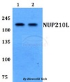 NUP210L Antibody - Western blot of NUP210L antibody at 1:500 dilution. Lane 1: HEK293T whole cell lysate. Lane 2: PC12 whole cell lysate.
