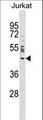 NUP43 Antibody - NUP43 Antibody western blot of Jurkat cell line lysates (35 ug/lane). The NUP43 antibody detected the NUP43 protein (arrow).