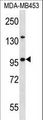 NUP88 Antibody - NUP88 Antibody western blot of MDA-MB453 cell line lysates (35 ug/lane). The NUP88 antibody detected the NUP88 protein (arrow).