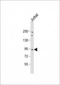 NUP93 Antibody - Anti-NUP93 Antibody (C-Term) at 1:1000 dilution + Jurkat whole cell lysate Lysates/proteins at 20 ug per lane. Secondary Goat Anti-Rabbit IgG, (H+L), Peroxidase conjugated at 1:10000 dilution. Predicted band size: 93 kDa. Blocking/Dilution buffer: 5% NFDM/TBST.