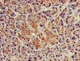 NUPR1 Antibody - Immunohistochemistry of paraffin-embedded human pancreatic tissue using NUPR1 Antibody at dilution of 1:100