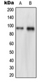 NVL Antibody - Western blot analysis of NVL expression in HeLa (A); THP1 (B) whole cell lysates.