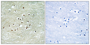 NXF / NPAS4 Antibody - Immunohistochemistry analysis of paraffin-embedded human brain tissue, using NPAS4 Antibody. The picture on the right is blocked with the synthesized peptide.