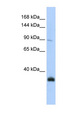 NXP2 / MORC3 Antibody - MORC3 antibody Western blot of Jurkat lysate. This image was taken for the unconjugated form of this product. Other forms have not been tested.