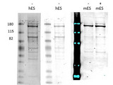 NXP2 / MORC3 Antibody - Western Blot of rabbit anti-Morc3 antibody. Lane 1: Human embryonic stem cell. Lane 2: Human embryonic stem cell. Lane 3: C-Flag Mouse embryonic stem cell. Lane 4: C-Flag Mouse embryonic stem cell doxycycline induced. Load: 35 µg per lane. Primary antibody: hMorc3 antibody at 1:1000-1:5000 for overnight at 4°C. Secondary antibody: rabbit secondary antibody at 1:10,000 for 45 min at RT. Block: 5% BLOTTO overnight at 4°C. Predicted/Observed size: 107kDa/ ~170kDa. Other band(s): sumoylated Morc run higher.