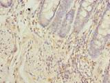 NXPE1 / FAM55A Antibody - Immunohistochemistry of paraffin-embedded human rectum tissue using antibody at dilution of 1:100.