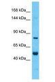 NYAP2 Antibody - NYAP2 antibody Western Blot of Thymus Tumor. Antibody dilution: 1 ug/ml.  This image was taken for the unconjugated form of this product. Other forms have not been tested.