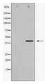 O3FAR1 / GPR120 Antibody - Western blot of GPR120 expression in PC12 cells