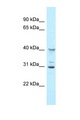 Oas1g Antibody - Oas1g antibody Western blot of Mouse Liver lysate. Antibody concentration 1 ug/ml.  This image was taken for the unconjugated form of this product. Other forms have not been tested.