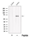 OAS2 Antibody - Western blot analysis of extracts of Jurkat cells using OAS2 antibody. The lane on the left was treated with blocking peptide.