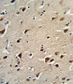 OAT Antibody - Formalin-fixed and paraffin-embedded human brain tissue reacted with OAT Antibody , which was peroxidase-conjugated to the secondary antibody, followed by DAB staining. This data demonstrates the use of this antibody for immunohistochemistry; clinical relevance has not been evaluated.