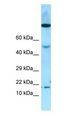 OBP2A Antibody - OBP2A antibody Western Blot of Fetal Stomach.  This image was taken for the unconjugated form of this product. Other forms have not been tested.