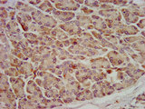 OCC1 Antibody - Immunohistochemistry image at a dilution of 1:600 and staining in paraffin-embedded human pancreatic tissue performed on a Leica BondTM system. After dewaxing and hydration, antigen retrieval was mediated by high pressure in a citrate buffer (pH 6.0) . Section was blocked with 10% normal goat serum 30min at RT. Then primary antibody (1% BSA) was incubated at 4 °C overnight. The primary is detected by a biotinylated secondary antibody and visualized using an HRP conjugated SP system.